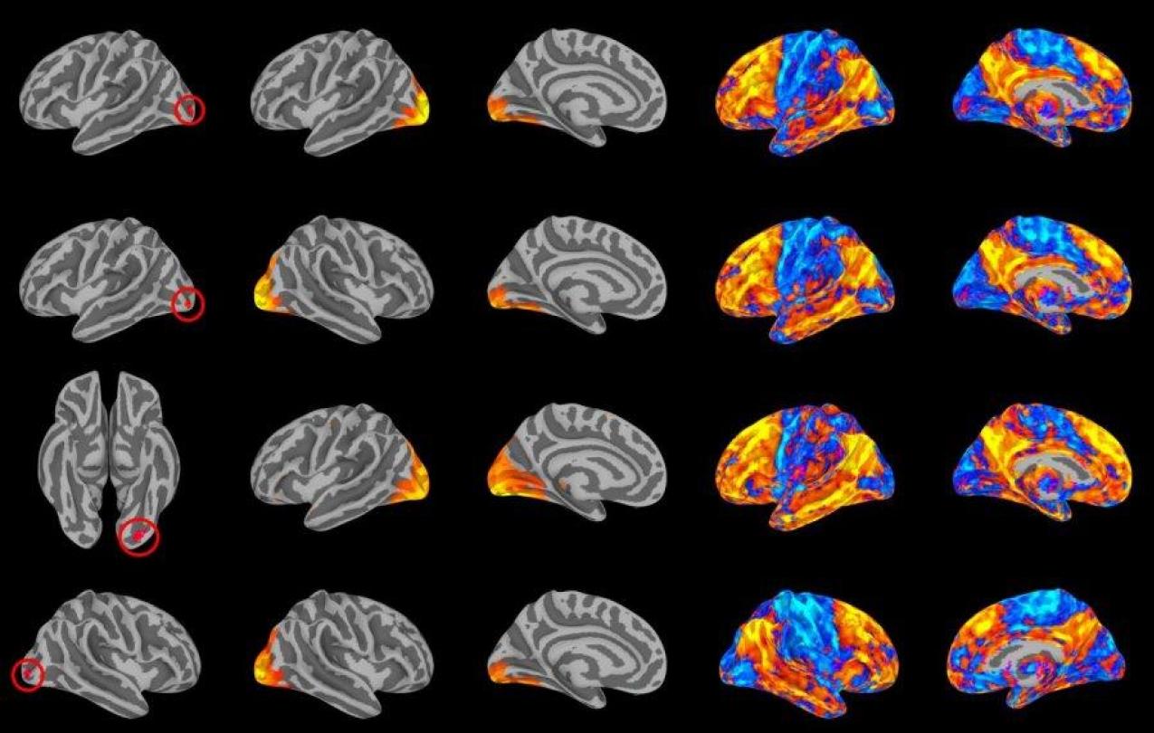Brain visual networks